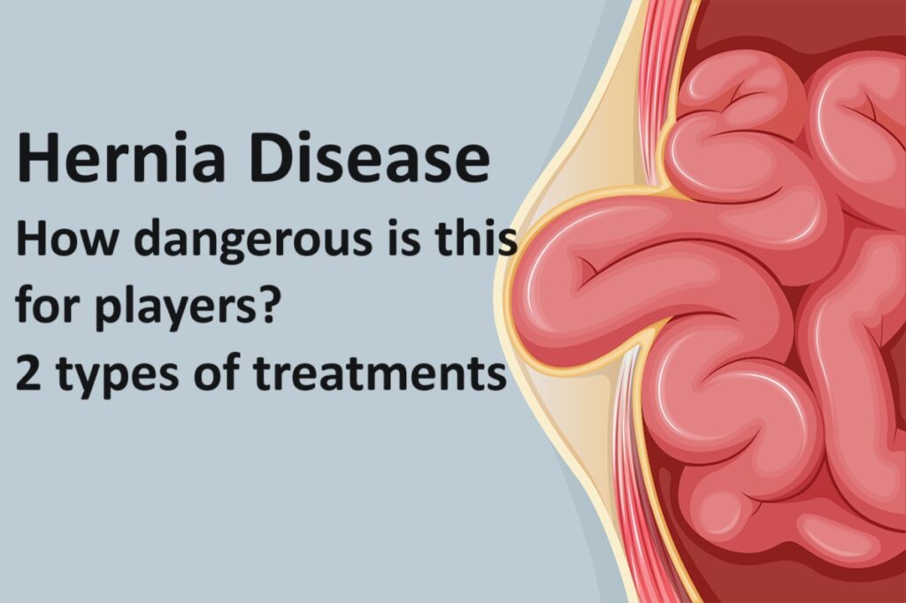 Hernia Disease-how dangerous is this disease for players?- 02 types of treatment