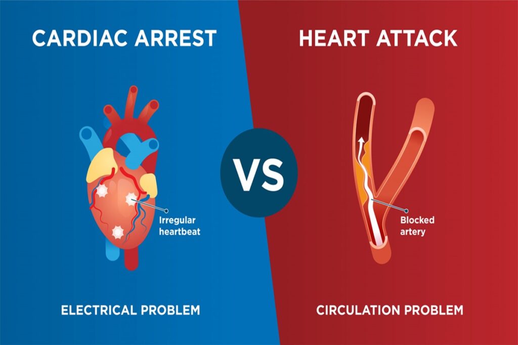 Cardiac Arrest and Heart Attack