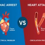 Cardiac Arrest and Heart Attack