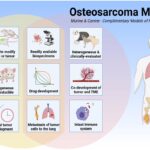 Osteosarcoma