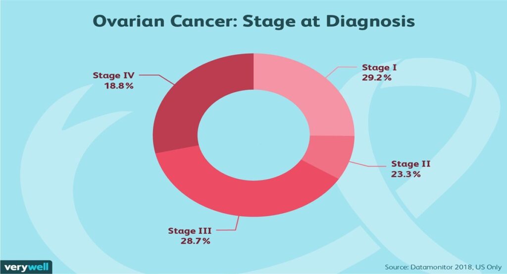 Ovarian Cancer