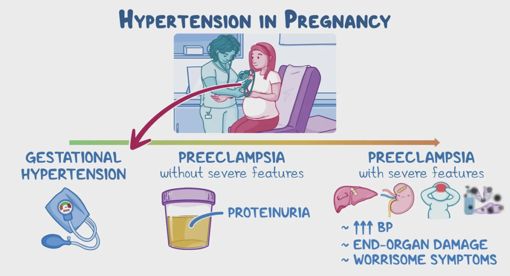 Gestational Diabetes